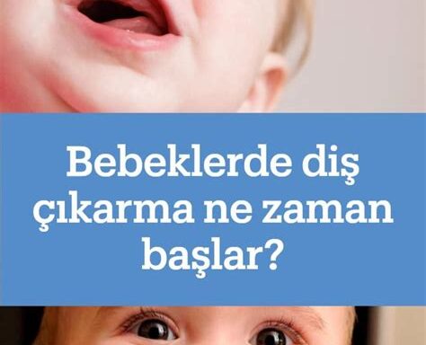 Bebeğinizin Diş Çıkarma Sürecinde Neler Yapabilirsiniz?