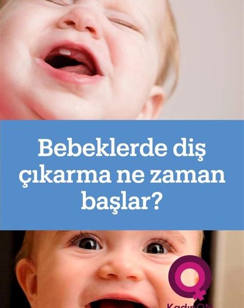 Bebeğinizin Diş Çıkarma Sürecinde Neler Yapabilirsiniz?